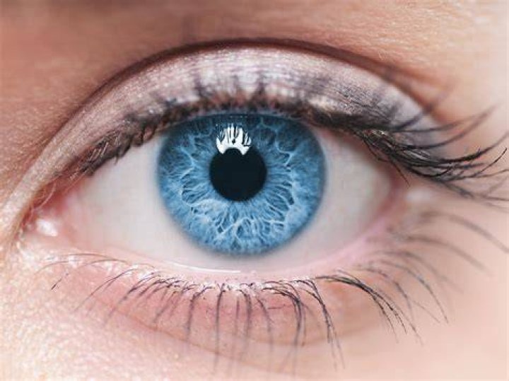 Are blue eyes the result of inbreeding?