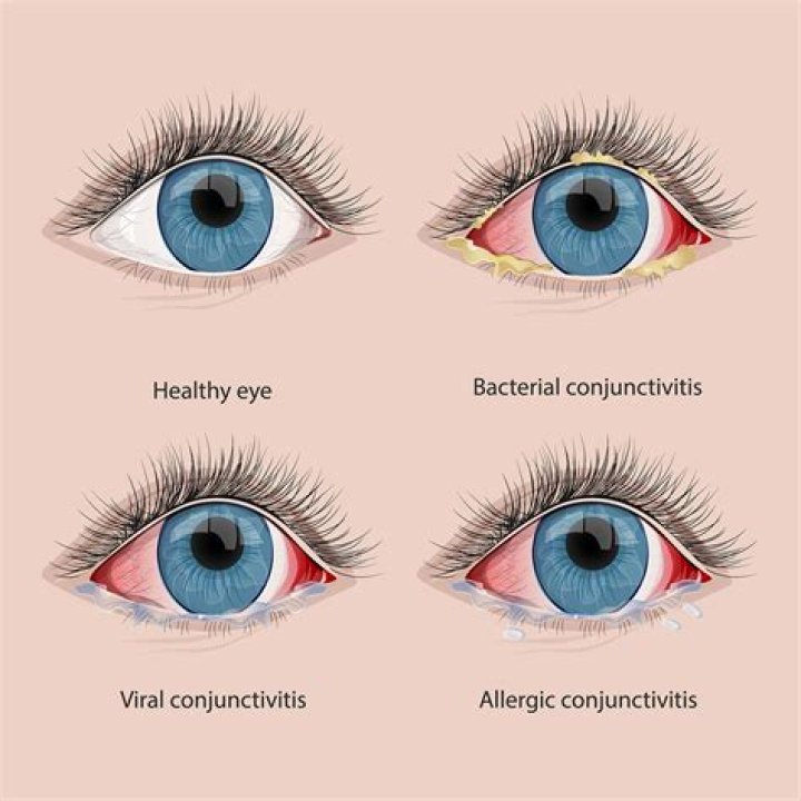 Can conjunctivitis spread to skin?