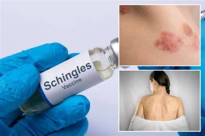 Can you get blood poisoning from shingles?