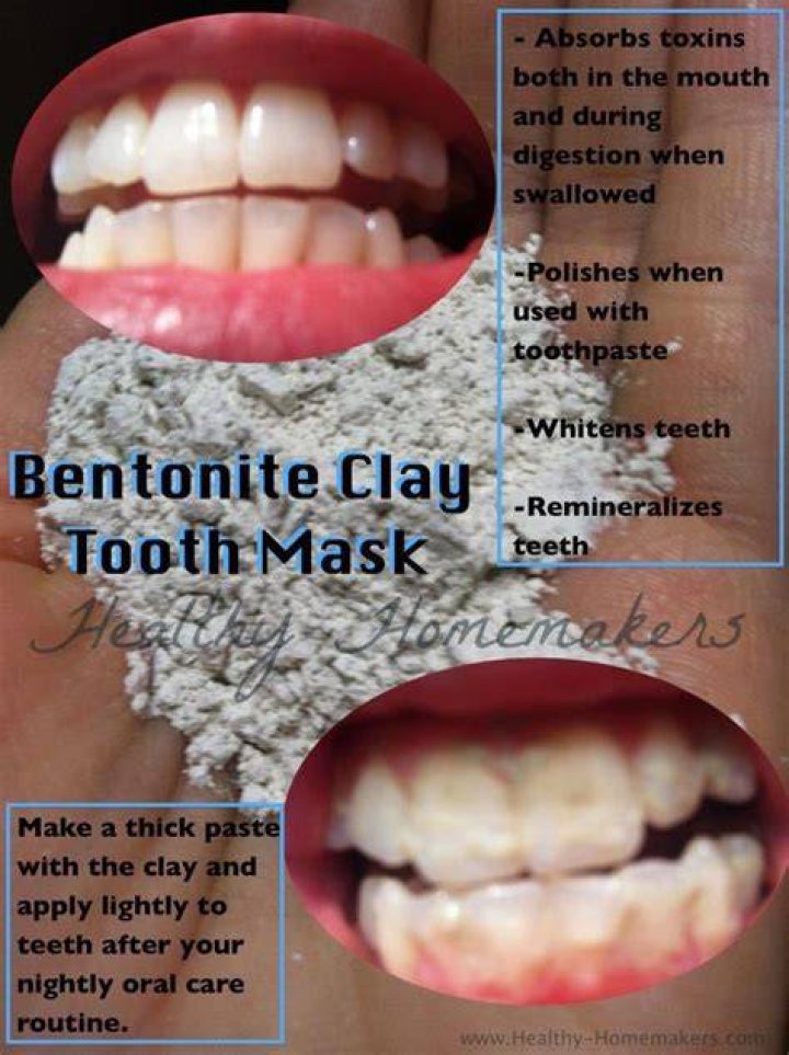 Can you use bentonite clay on teeth?
