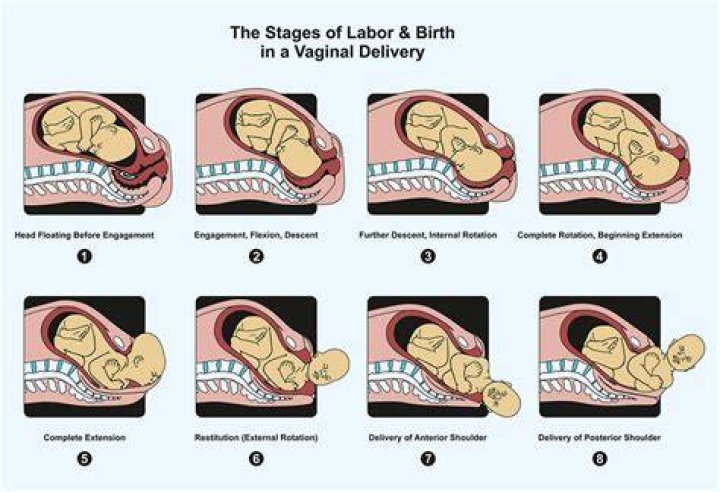Do you have contractions when delivering the placenta?