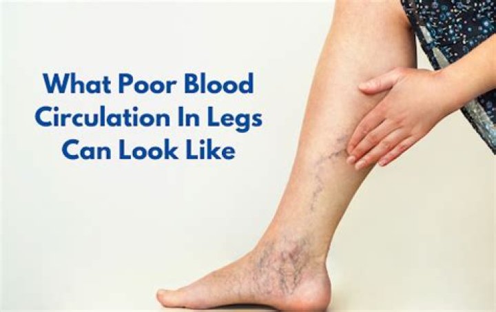 Does poor circulation cause hair loss on legs?