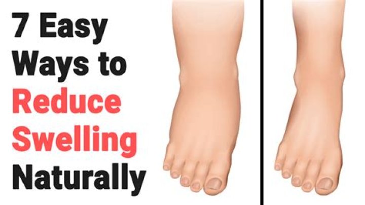 How do I reduce swelling in my body?