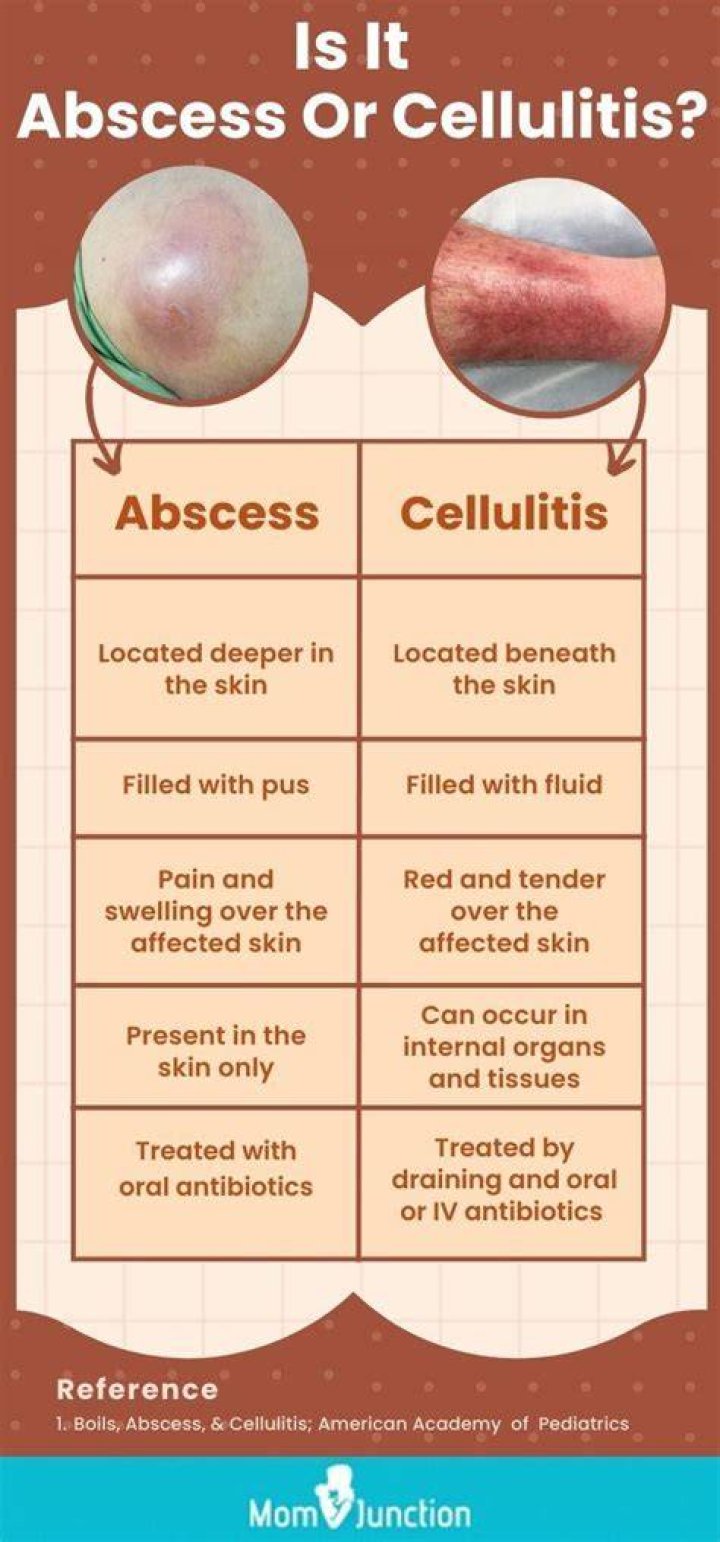 How do you get rid of an abscess in your ear?