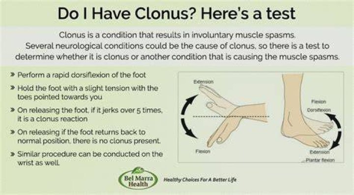 How do you test a baby for clonus?