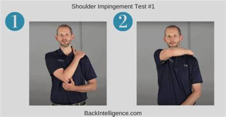 How do you test for impingement syndrome?
