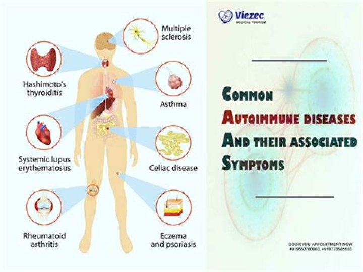 Is CCCA an autoimmune disease?