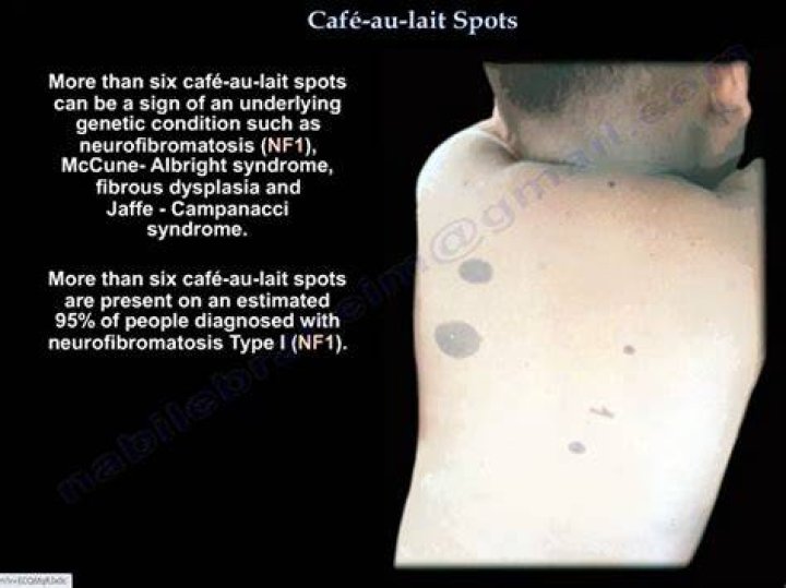What are Cafe Ole spots?