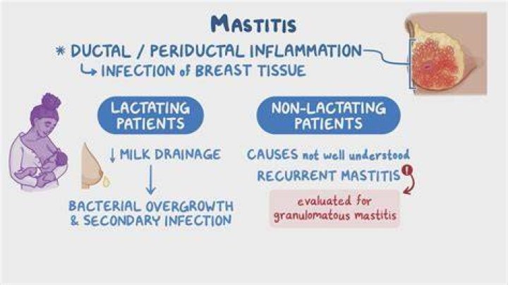What bug causes mastitis?