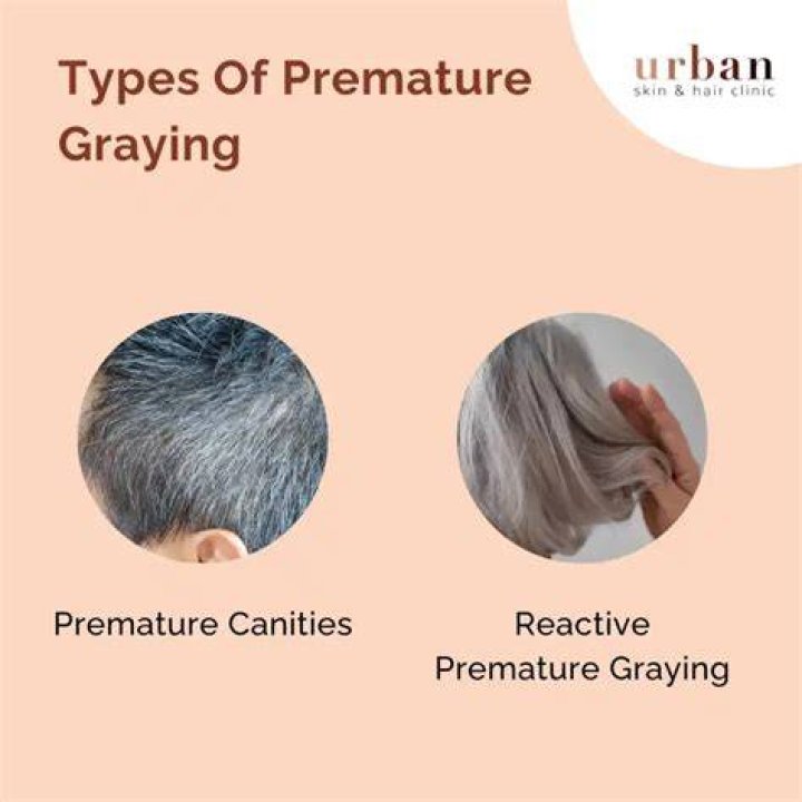 What causes premature Greying of beard?
