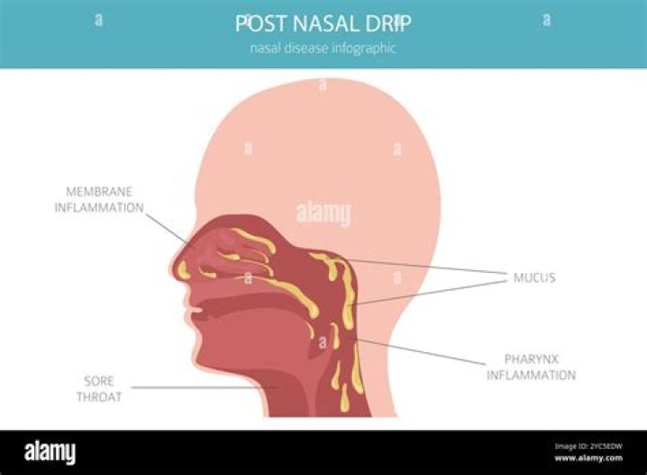 What does the post mean in post-nasal drip?