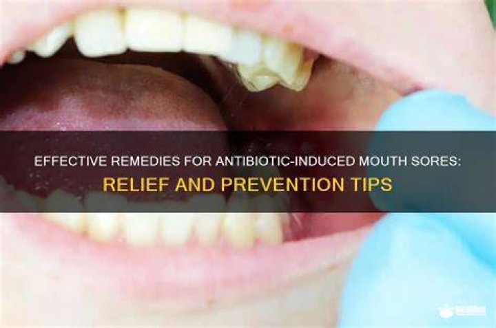 What helps mouth sores from antibiotics?
