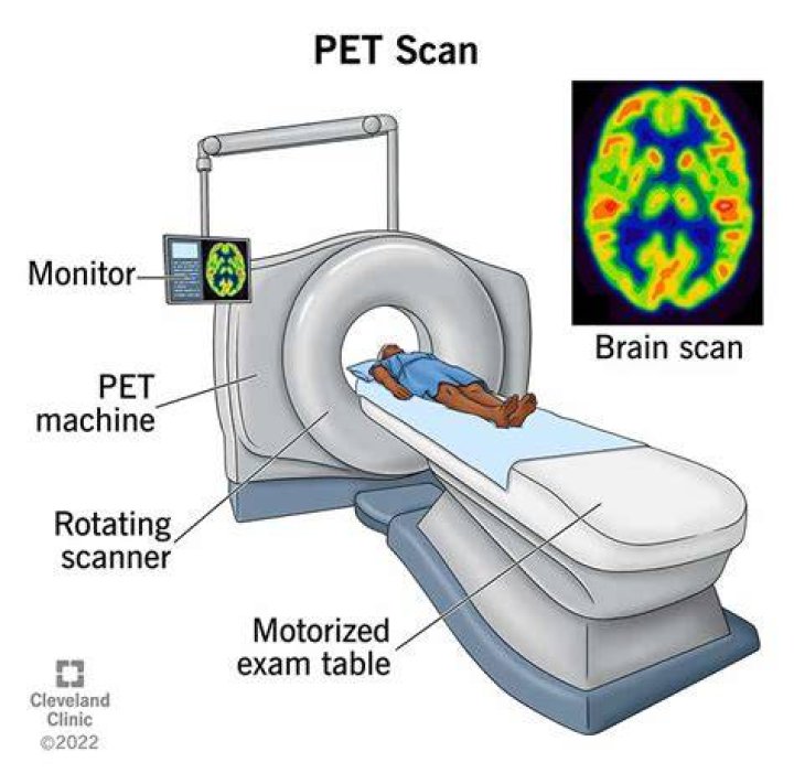 What is a PET scan used to diagnose?