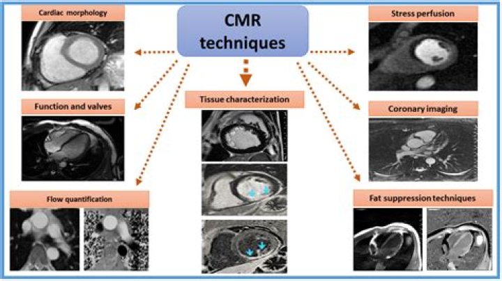 What is CMR in cardiology?