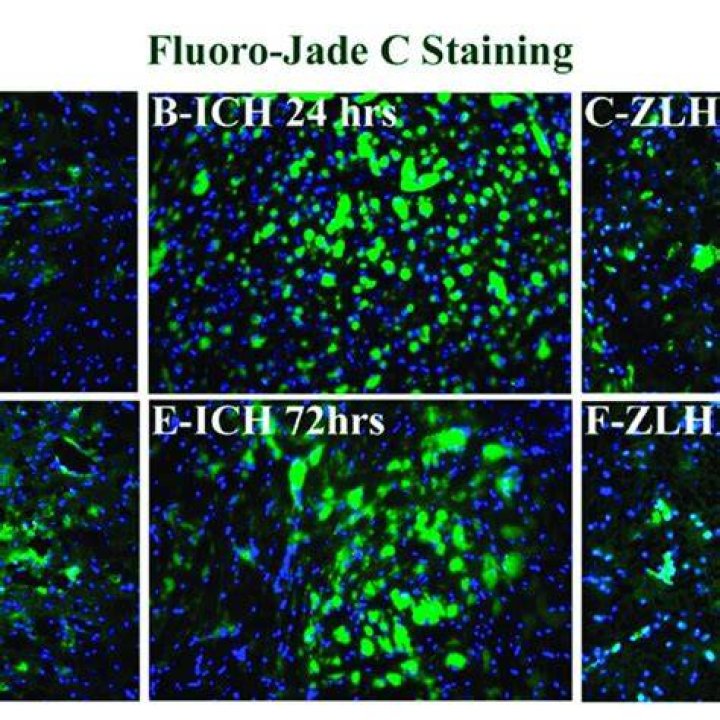 What is fluoro-jade c?