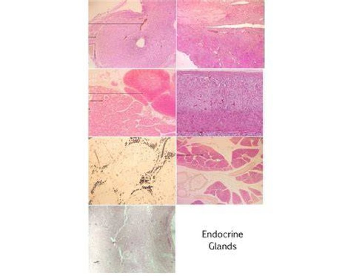 What is red gland?