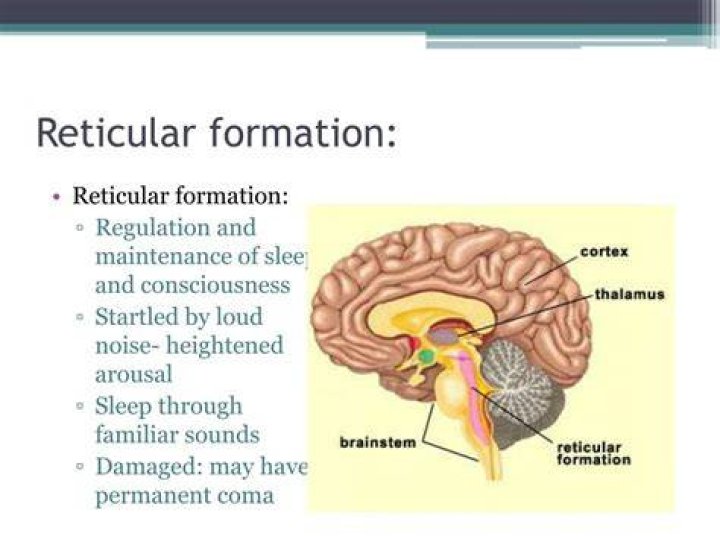 What is the reticular formation?