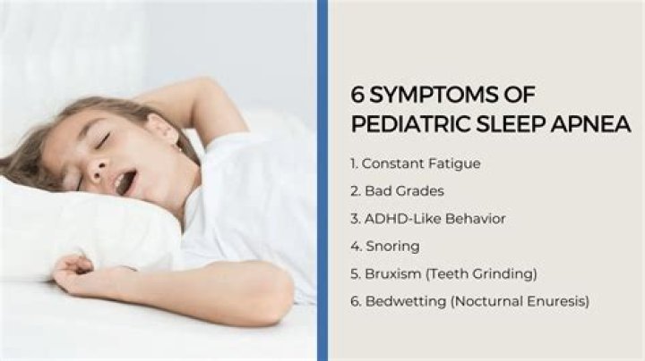 What might be a physical symptom of sleep apnea or sleep disordered breathing in children?