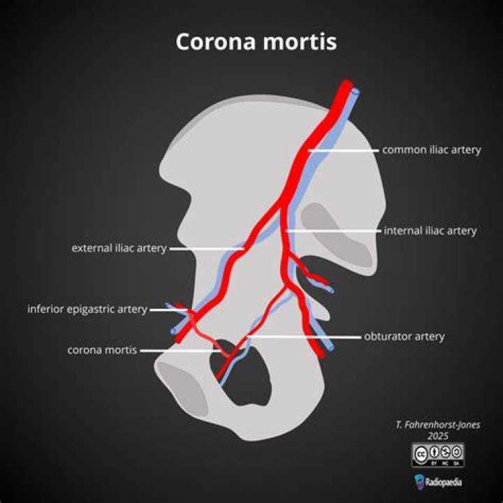 Why is it called corona mortis?